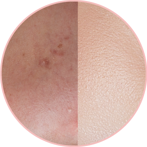 Fem-Fairness-Naturals-Saffron-Bleach-3144-Gm-FM046314